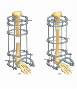 TIBIA 6.5