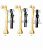 FEMUR 2.1