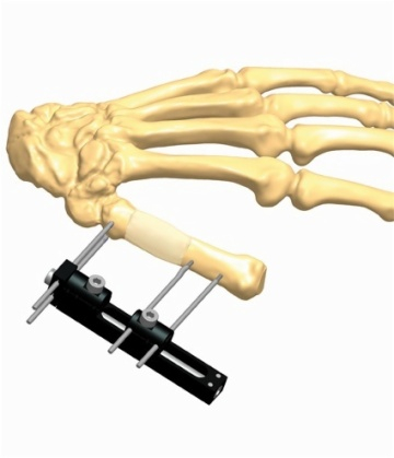 hand 4.3