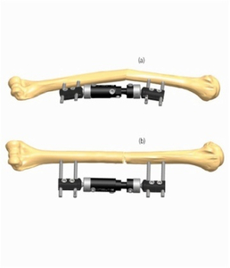 HUMERUS 2.1