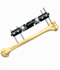 HUMERUS 1.6