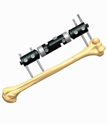HUMERUS 1.6