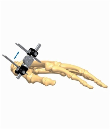 Hand 3.1
