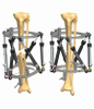 TIBIA 1.3